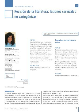 RevisiÃ³n de la literatura: lesiones cervicales no cariogÃ©nicas - COEM