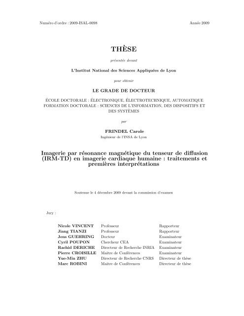 Imagerie par résonance magnétique du tenseur de diffusion (IRM ...