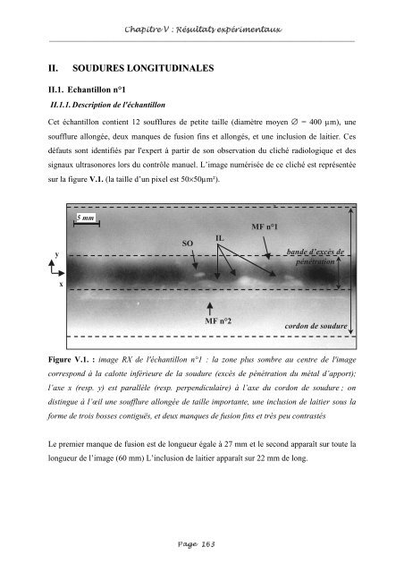 Fusion entre les données ultrasonores et les images de radioscopie ...