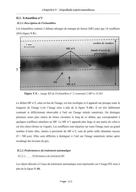 Fusion entre les données ultrasonores et les images de radioscopie ...