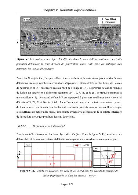 Fusion entre les données ultrasonores et les images de radioscopie ...