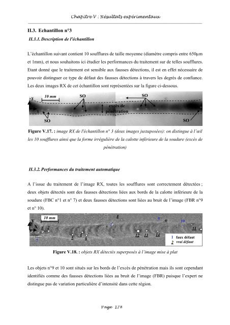 Fusion entre les données ultrasonores et les images de radioscopie ...