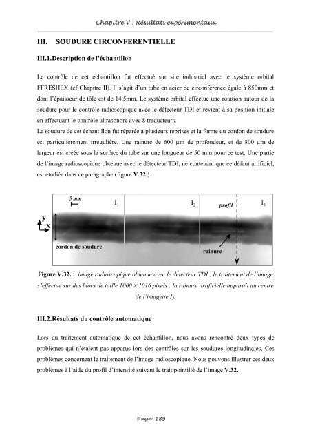 Fusion entre les données ultrasonores et les images de radioscopie ...