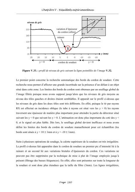 Fusion entre les données ultrasonores et les images de radioscopie ...