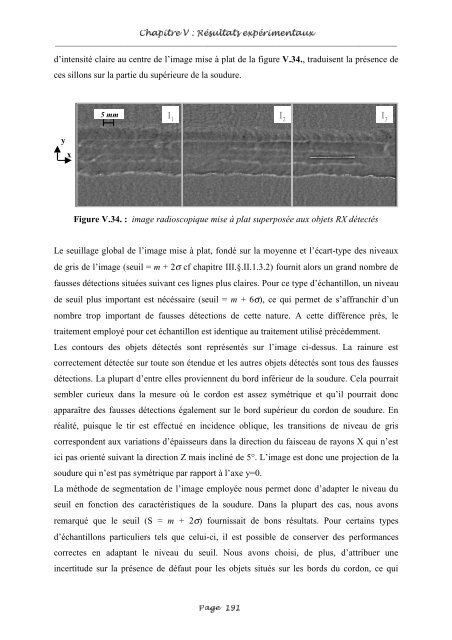 Fusion entre les données ultrasonores et les images de radioscopie ...