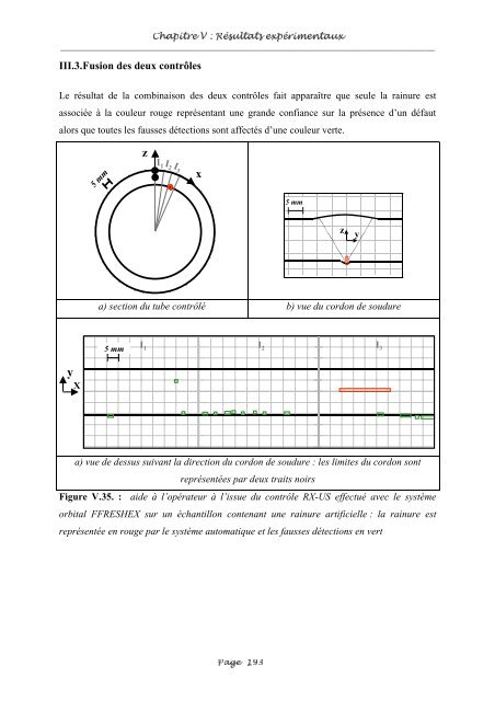 Fusion entre les données ultrasonores et les images de radioscopie ...