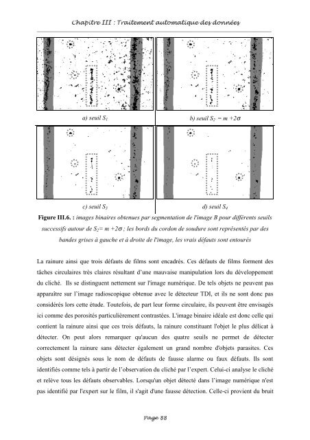 Fusion entre les données ultrasonores et les images de radioscopie ...