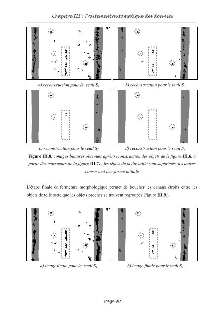 Fusion entre les données ultrasonores et les images de radioscopie ...