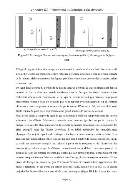 Fusion entre les données ultrasonores et les images de radioscopie ...