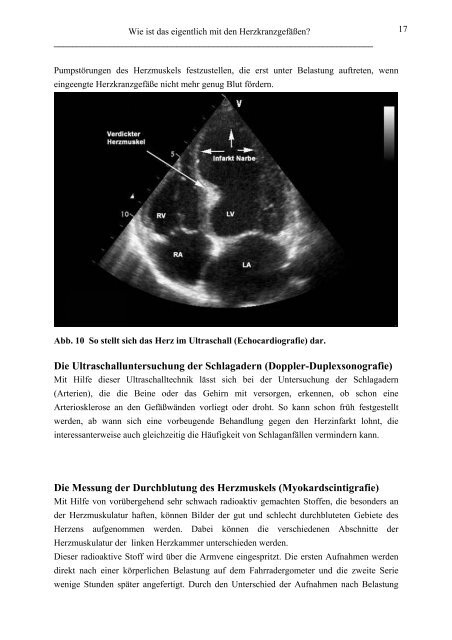 KHK Patienteninformation mit Biografie breiter Rand - theHeart.de