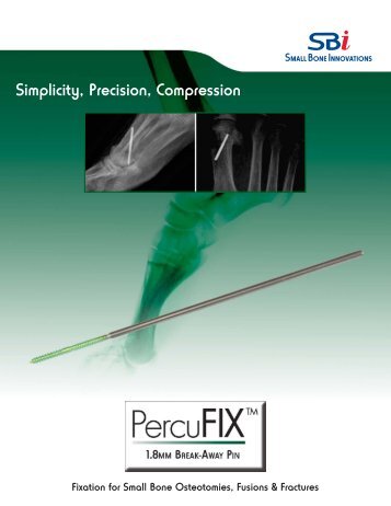 Download the Brochure - Small Bone Innovations
