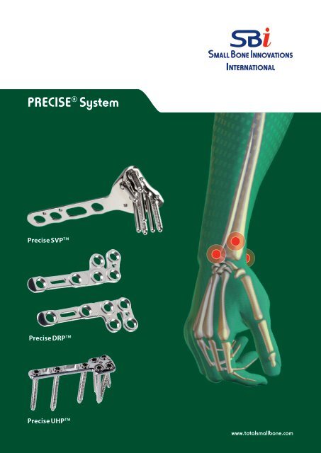 PreciseÂ® System Surgical Technique - Small Bone Innovations