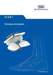 AutoFIX Product Brochure - Small Bone Innovations