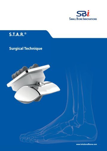 Download the STARâ¢ Ankle Surgical Technique PGT ...