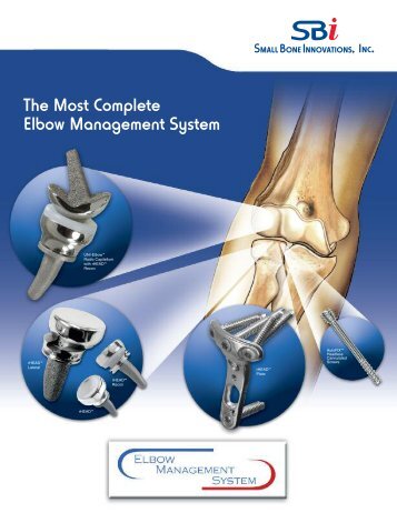 The Most Complete Elbow Management System - Small Bone ...
