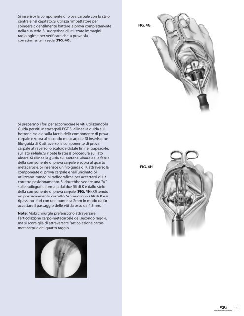 Download the RE-MOTIONâ¢ Surgical Technique - Small Bone ...