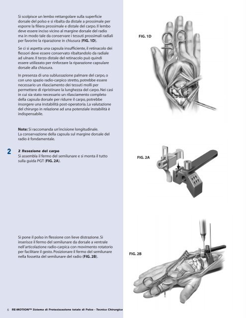 Download the RE-MOTIONâ¢ Surgical Technique - Small Bone ...