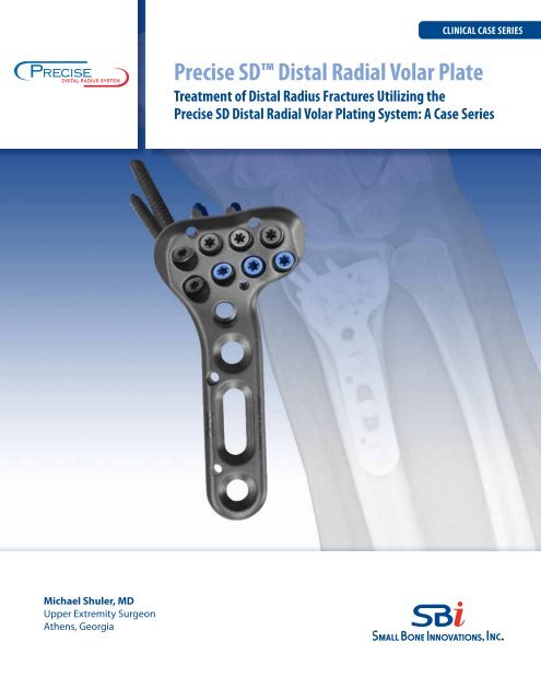 Precise SDâ ¢ Distal Radial Volar Plate - Small Bone Innovations