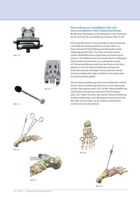 [SBi] STARÂ® Operationstechnik | 26.02.2010 - Small Bone Innovations