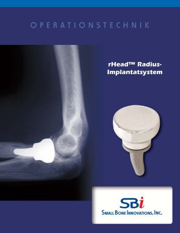 rHeadâ¢ Surgical Technique - Small Bone Innovations