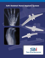 Download the Product Brochure - Small Bone Innovations