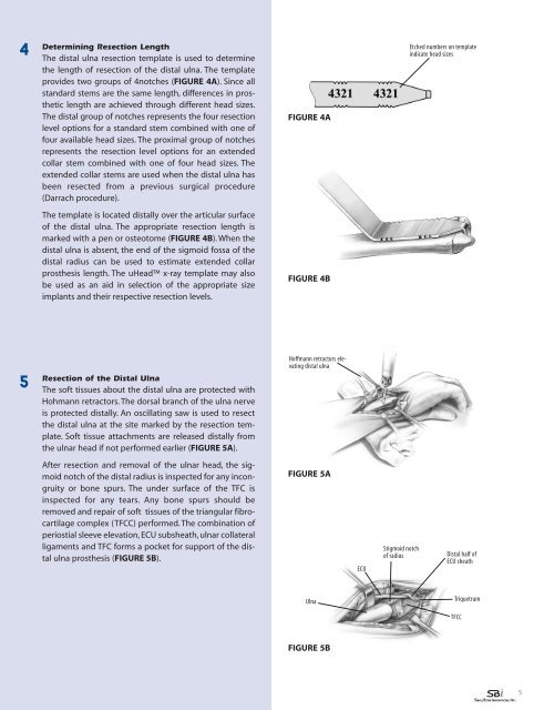 Download the uHead Surgical Technique - Small Bone Innovations