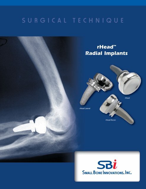 Download the rHeadâ¢ RECON Surgical Technique - Small Bone ...