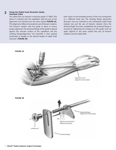 Download the rHeadâ¢ RECON Surgical Technique - Small Bone ...