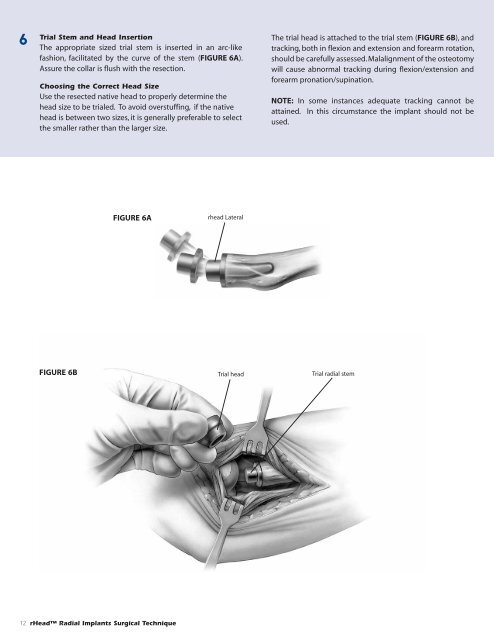 Download the rHeadâ¢ RECON Surgical Technique - Small Bone ...