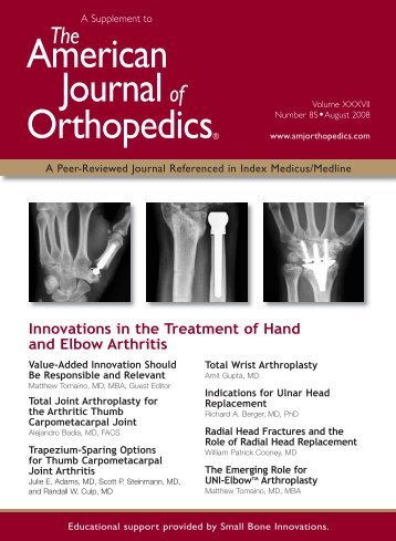 American Journalof OrthopedicsÂ® - Small Bone Innovations