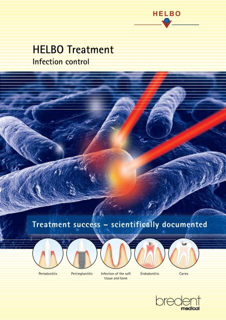 HELBO Treatment - bredent medical GmbH & Co.KG