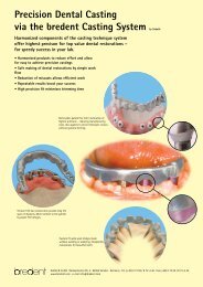 Precision Dental Casting via the bredent Casting System by Sabath