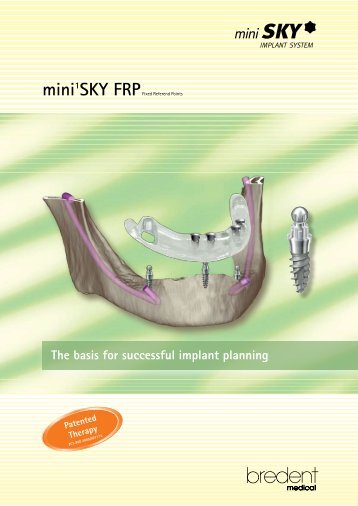 mini1SKY FRP - bredent medical GmbH & Co.KG