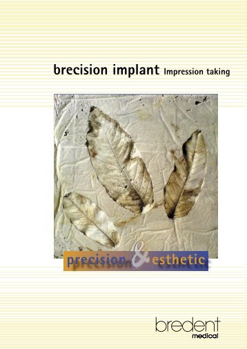 brecision implant - bredent medical GmbH & Co.KG
