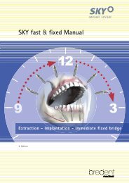 SKY fast & fixed Manual - bredent medical GmbH & Co.KG