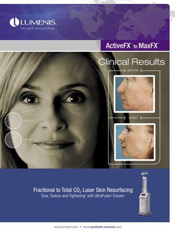 Clinical Results - Lumenis Aesthetic
