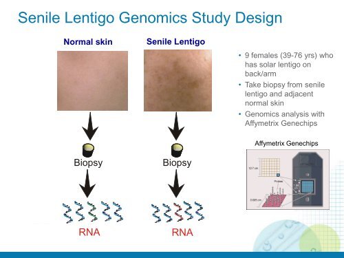 the role of adrenergic beta receptors for skin pigmentation