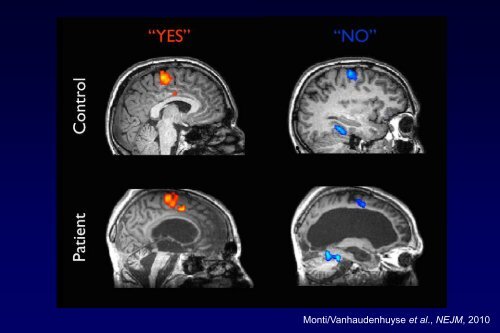 et al - Organization for Human Brain Mapping