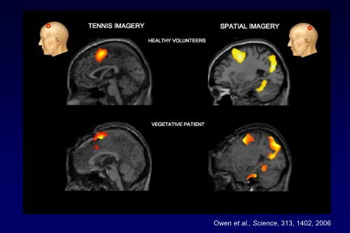 et al - Organization for Human Brain Mapping