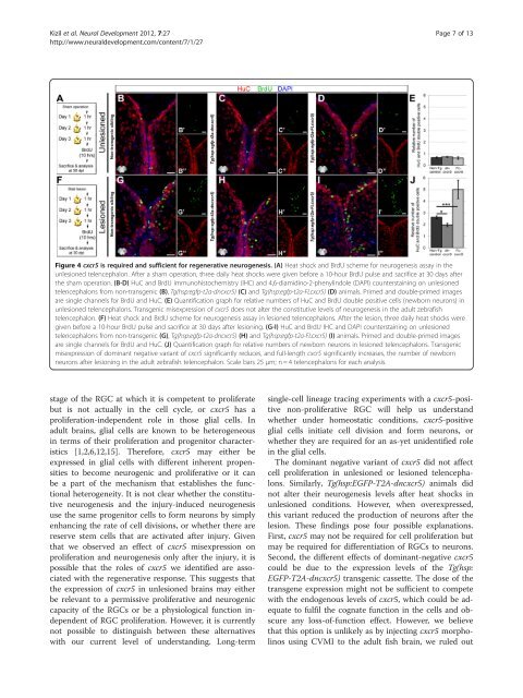 PDF - Neural Development