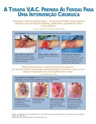 A TERAPIA V.A.C. PREPARA AS FERIDAS PARA - Efe