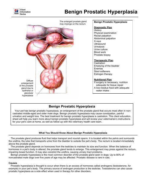 nutrition and benign prostatic hyperplasia