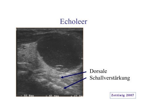 Grundlagen des Ultraschalls (3.2 MB)