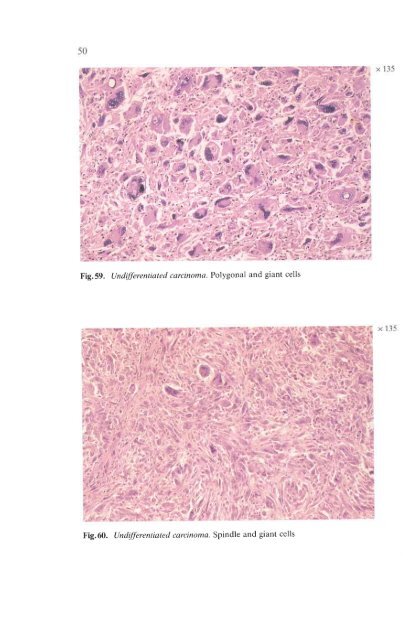 Histological Typing of Thyroid Tumours - libdoc.who.int - World ...