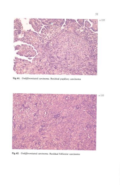 Histological Typing of Thyroid Tumours - libdoc.who.int - World ...