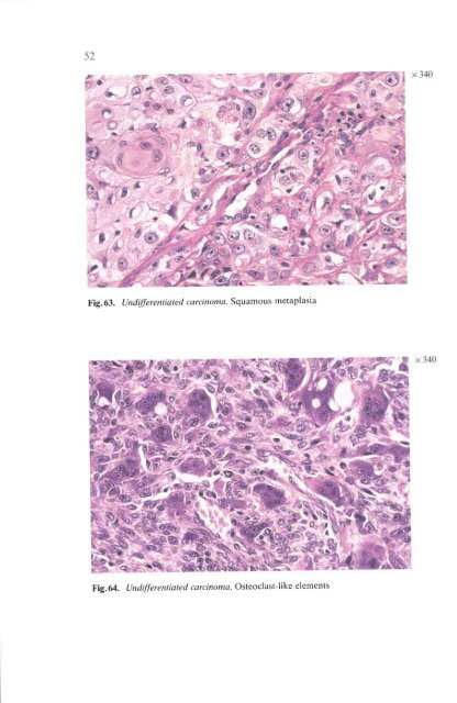 Histological Typing of Thyroid Tumours - libdoc.who.int - World ...