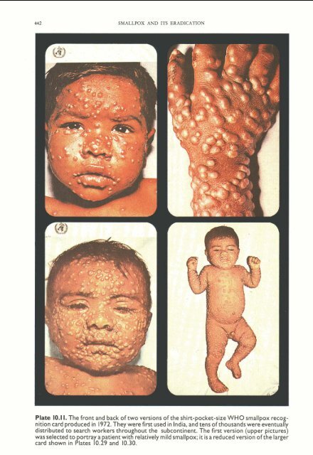 smallpox eradication - libdoc.who.int - World Health Organization