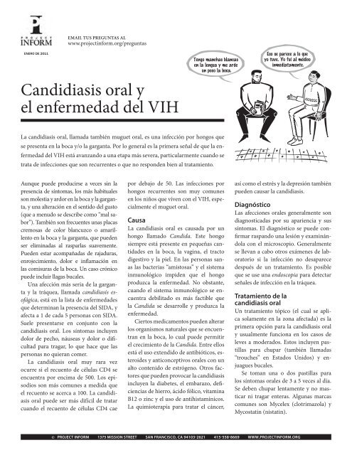 Candidiasis oral y el enfermedad del VIH - Project Inform