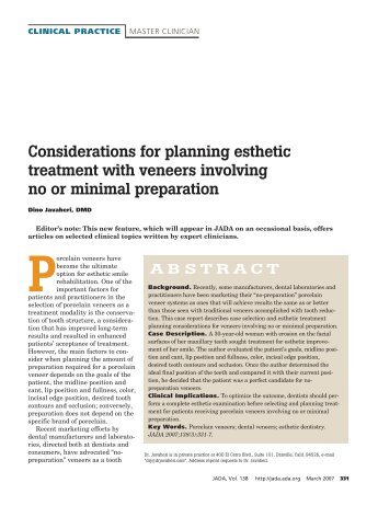 Considerations For Planning Esthetic Treatment With veneers