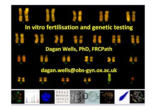 infertility treatments, genes and chromosomes